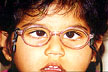 Corrected by Bifocal Glasses